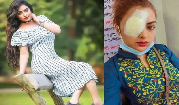 লেন্স গলে গিয়ে নায়িকার চোখের বারটা বেজেছে!