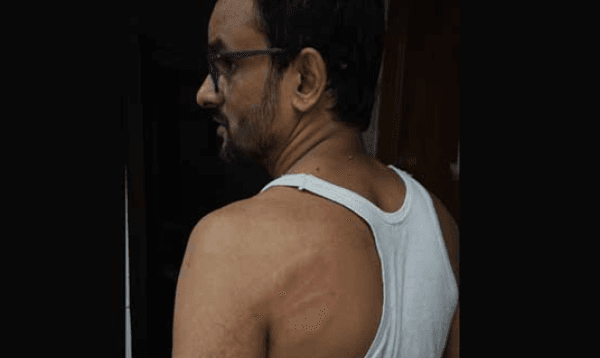 অফিস থেকে বাড়ি ফেরার পথে নরসিংদীতে সাংবাদিকের ওপর হামলা
