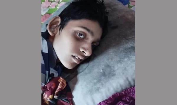 গরম পানি ঢাললেন সৎ মা, প্রতিবন্ধী ছেলের মৃত্যু