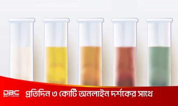 কোন রঙের প্রস্রাব কোন রোগের বার্তা দেয়